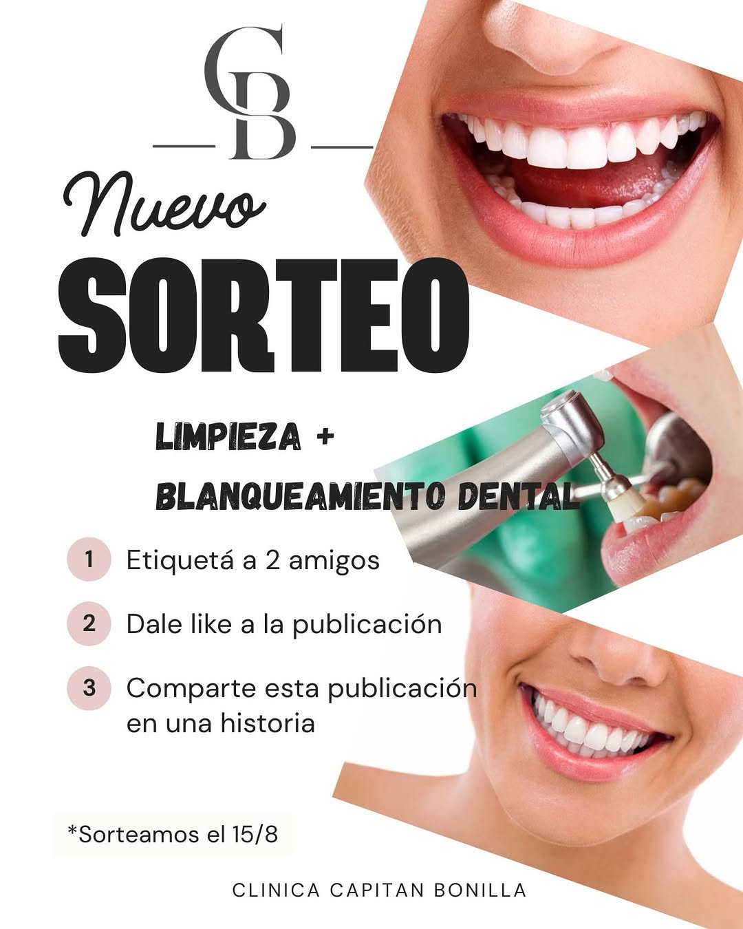 Imagen de ✨🦷 ¡NUEVO SORTEO DE LIMPIEZA DENTAL + BLANQUEAMIENTO! 